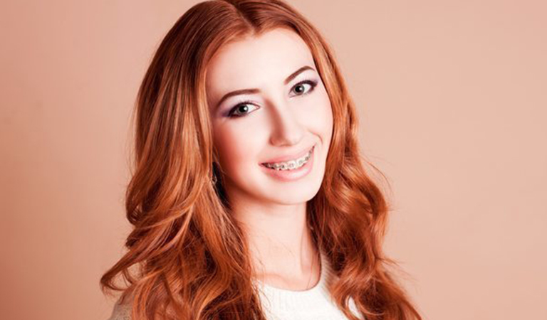 Invisalign Teen Vs Braces For Adolescents 2 Blog 69