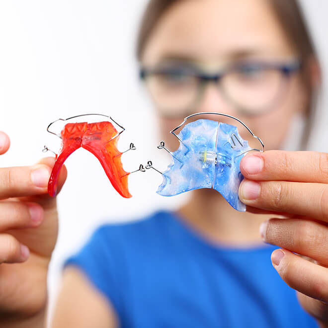Expanders 1 Orthodontic Expander What is orthodontic expander?