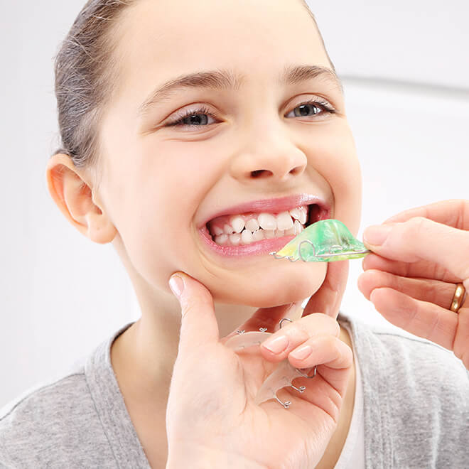 Expanders 3 Orthodontic Expander Benefits of orthodontic expanders