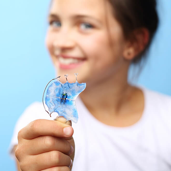 Expanders 5 Orthodontic Expander How long will my child have to wear an expander?