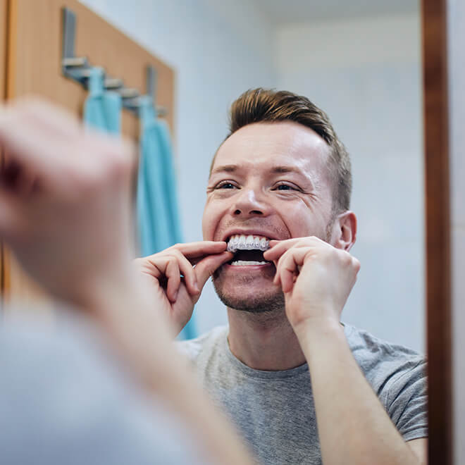 Accelerated Treatment 3 How does invisalign® treatment work?
